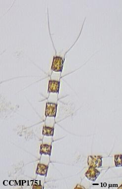 CCMP1751 | NCMA at Bigelow Laboratory